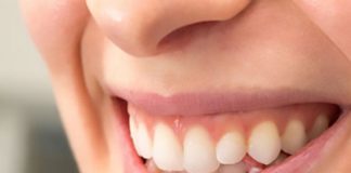 Tips On Combating Gum Recession Gum
